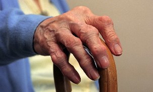 Αρθρίτιδα και αρθρίτιδα των δακτύλων σε ηλικιωμένο άτομο