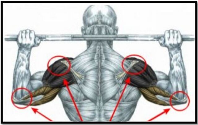 Το φορτίο στους μύες του ώμου και του αγκώνα είναι μία από τις αιτίες της αρθρώσεως της άρθρωσης του ώμου